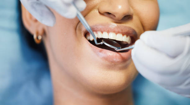 Best Emergency Dental Care for Abscessed Tooth in Malone, FL