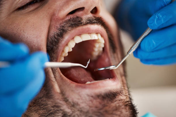 Best Emergency Dentist for Knocked-Out Tooth in Malone, FL