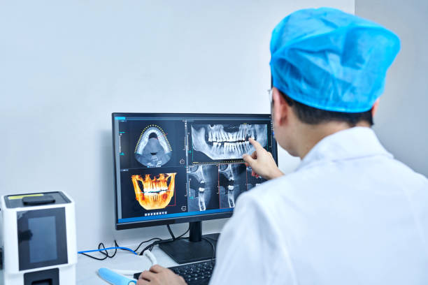 Best Emergency Dentist for Lost Fillings or Crowns in Malone, FL